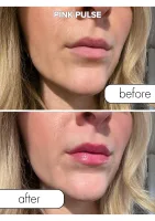 Lesk na pery s feromónmi Pink Pulse 8 ml — obrázok 6